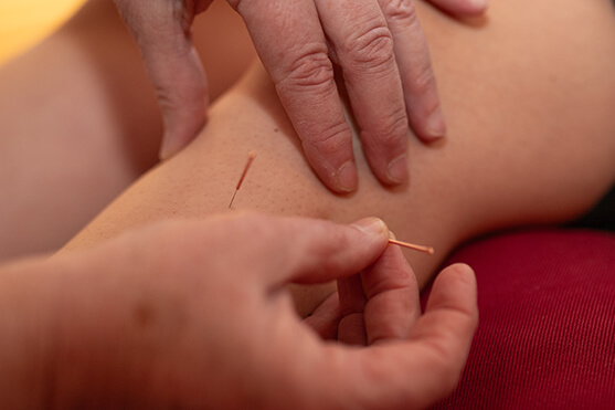 Erdenlicht Hebammenpraxis weitere Angebote Akupunktur